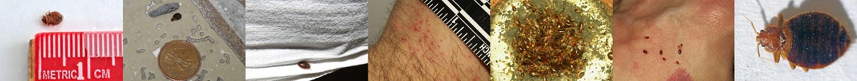 Bettwanzen bekämpfen Bettwanzenbekämpfung Bettwanzenbisse Bettwanzenstiche Schädlingsbekämpfung Kammerjäger