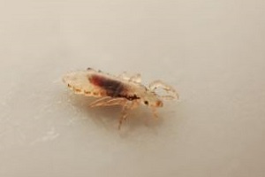 Kopflaus bekaempfen Pediculus humanus Kopflausbekaempfung Kammerjaeger Schaedlingsbekaempfung Allessauber