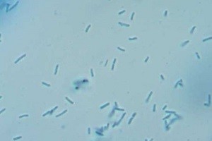 Legionellen Bakterien desinfektion thermisch chemisch abtöten desinfizieren erhitzen Allessauber