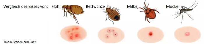 Vergleich des Bisses von Floh Bettwanze Milbe Mücke Kammerjäger Schädlingsbekämpfung Allessauber